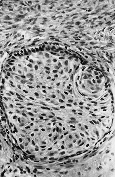 Ovary Cell