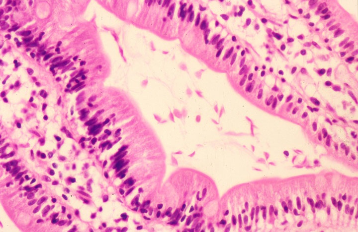 giardia histology stain