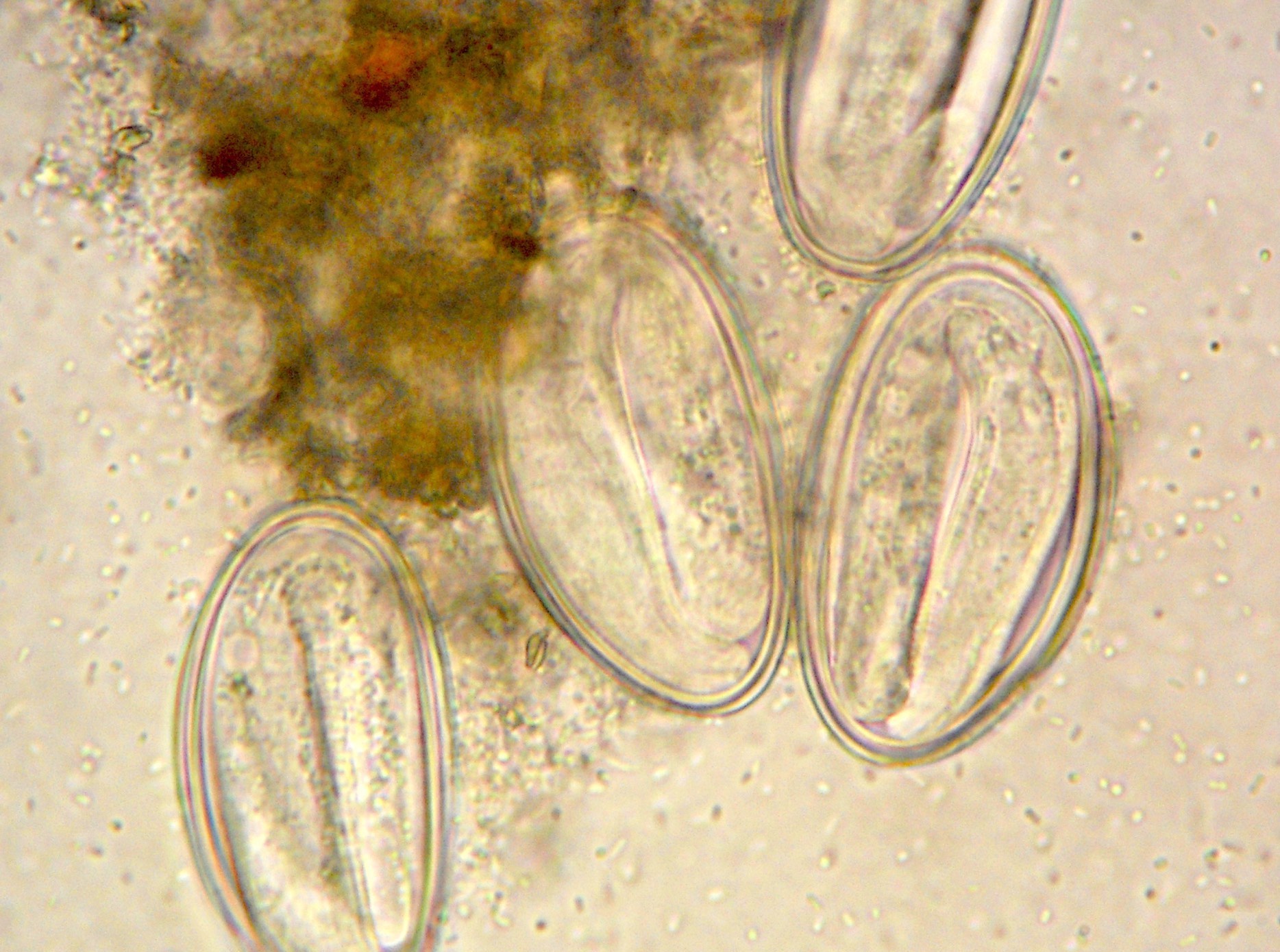 Enterobius vermicularis яйца