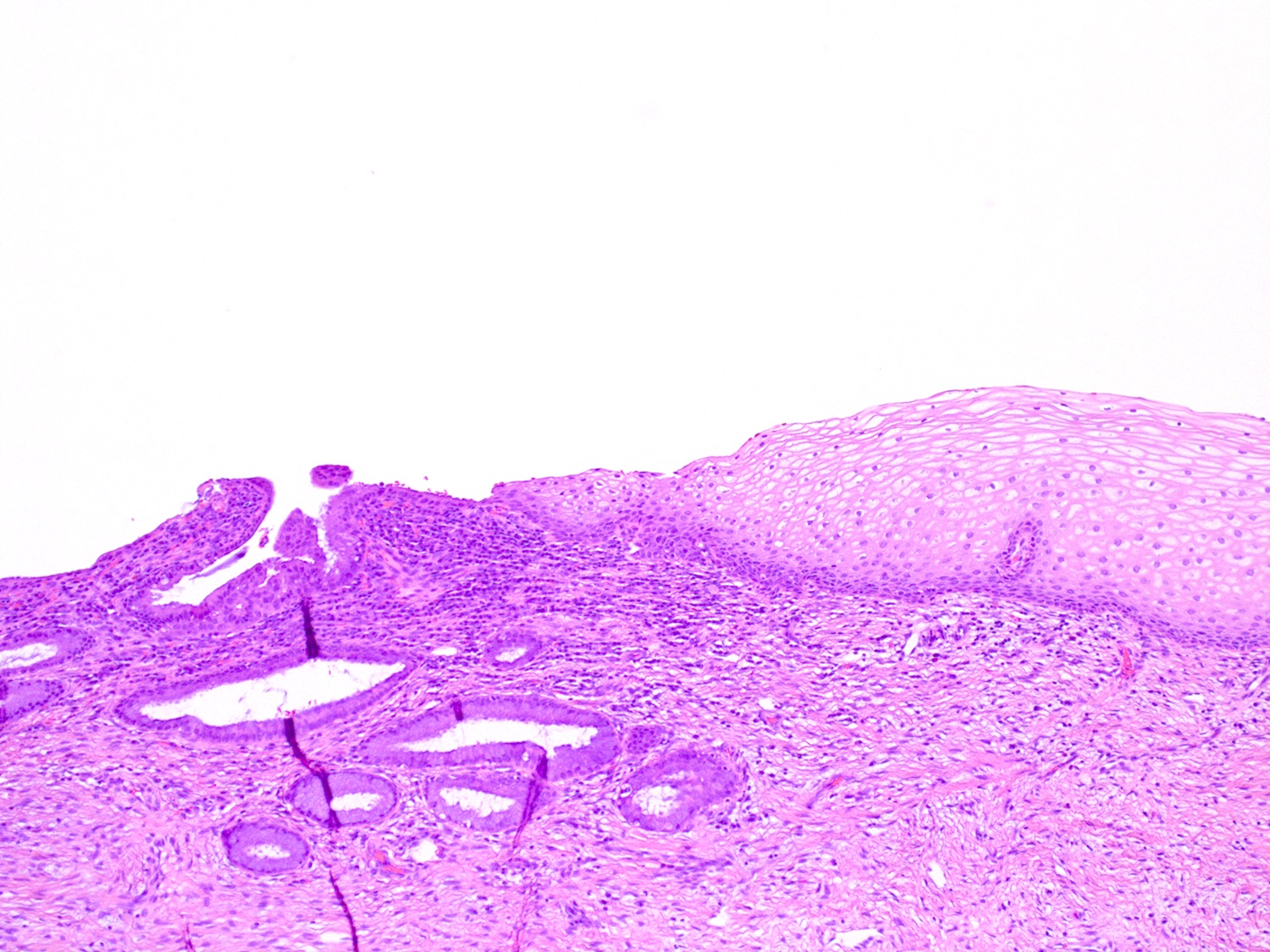 Normal Cervix Histology