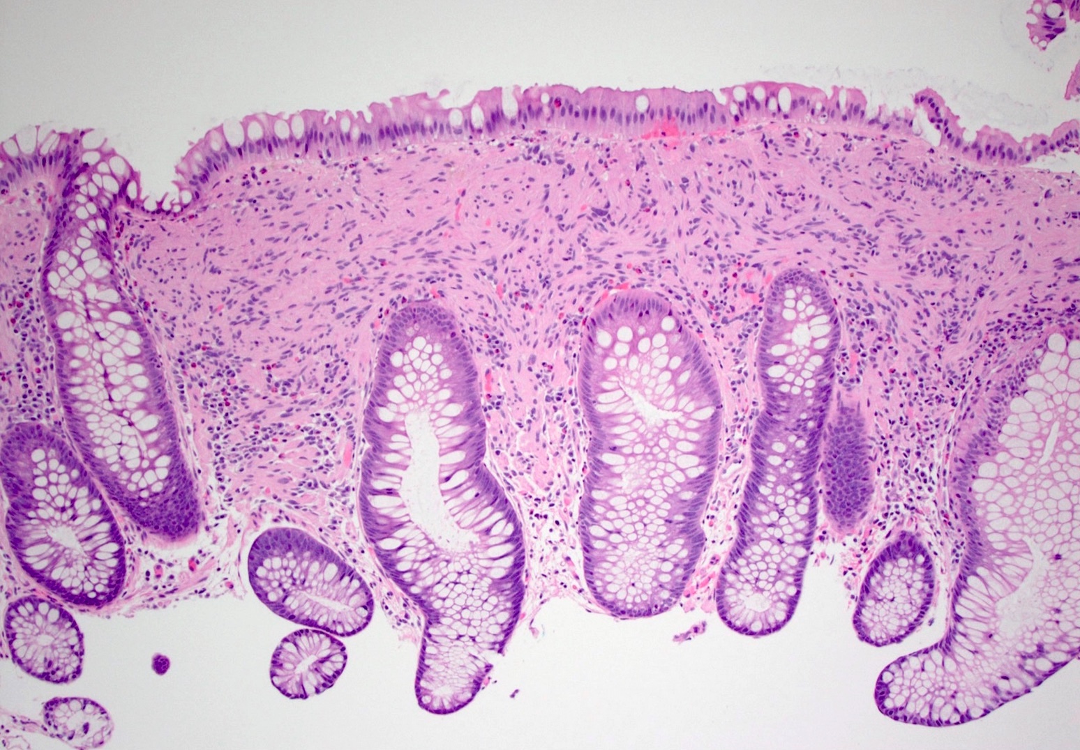 Schwann Cells Histology