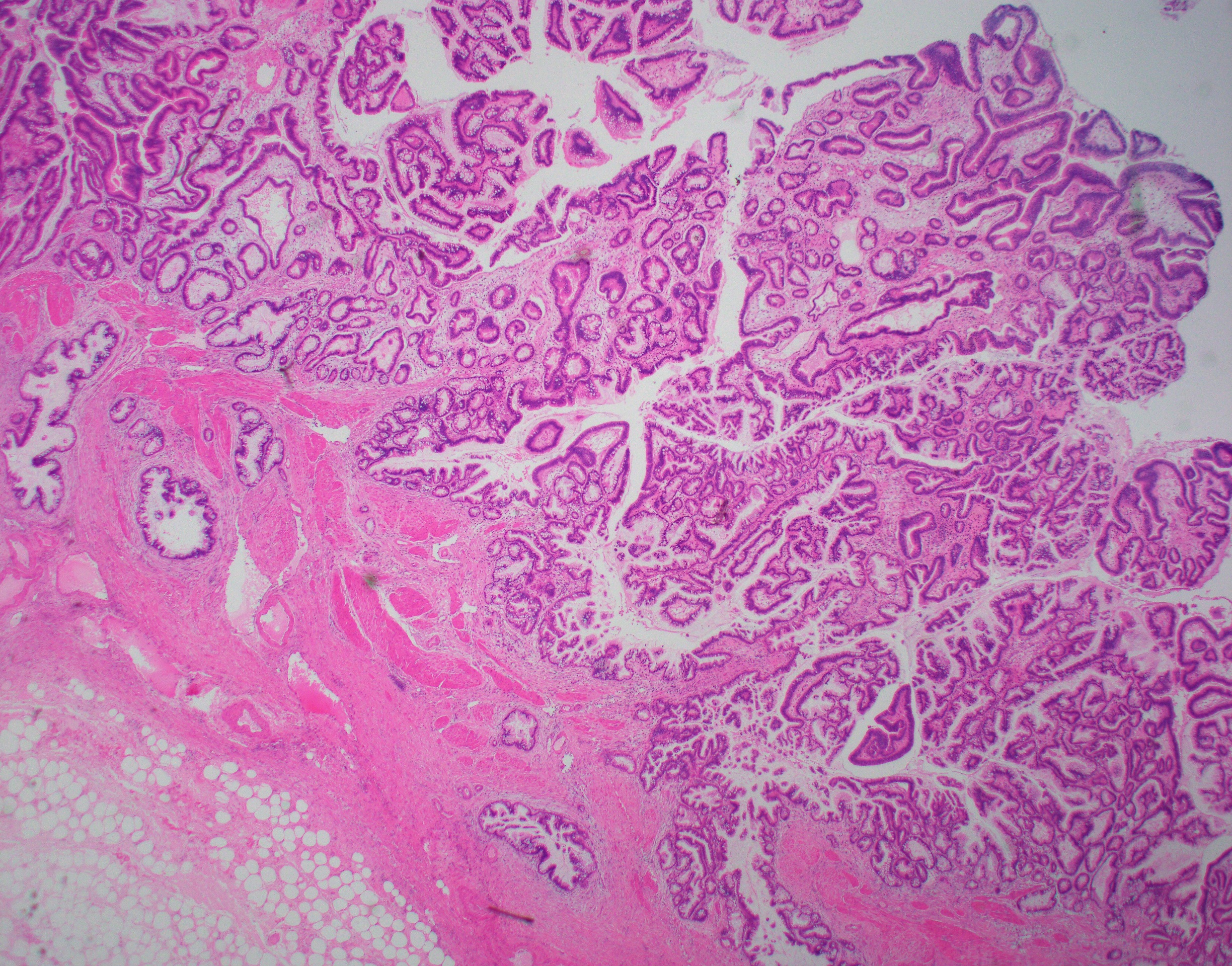 Histology Of Gallbladder