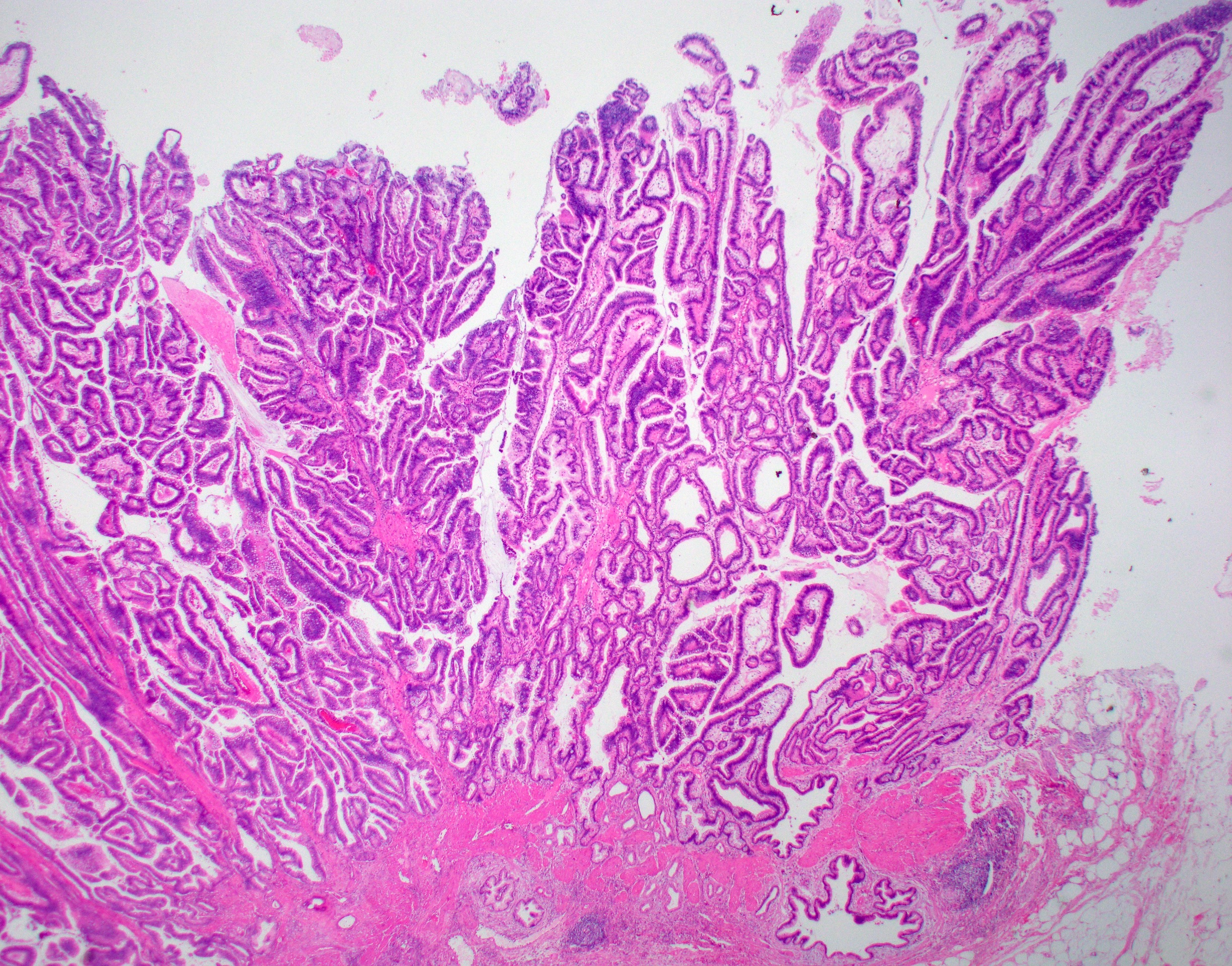Gallbladder Histology