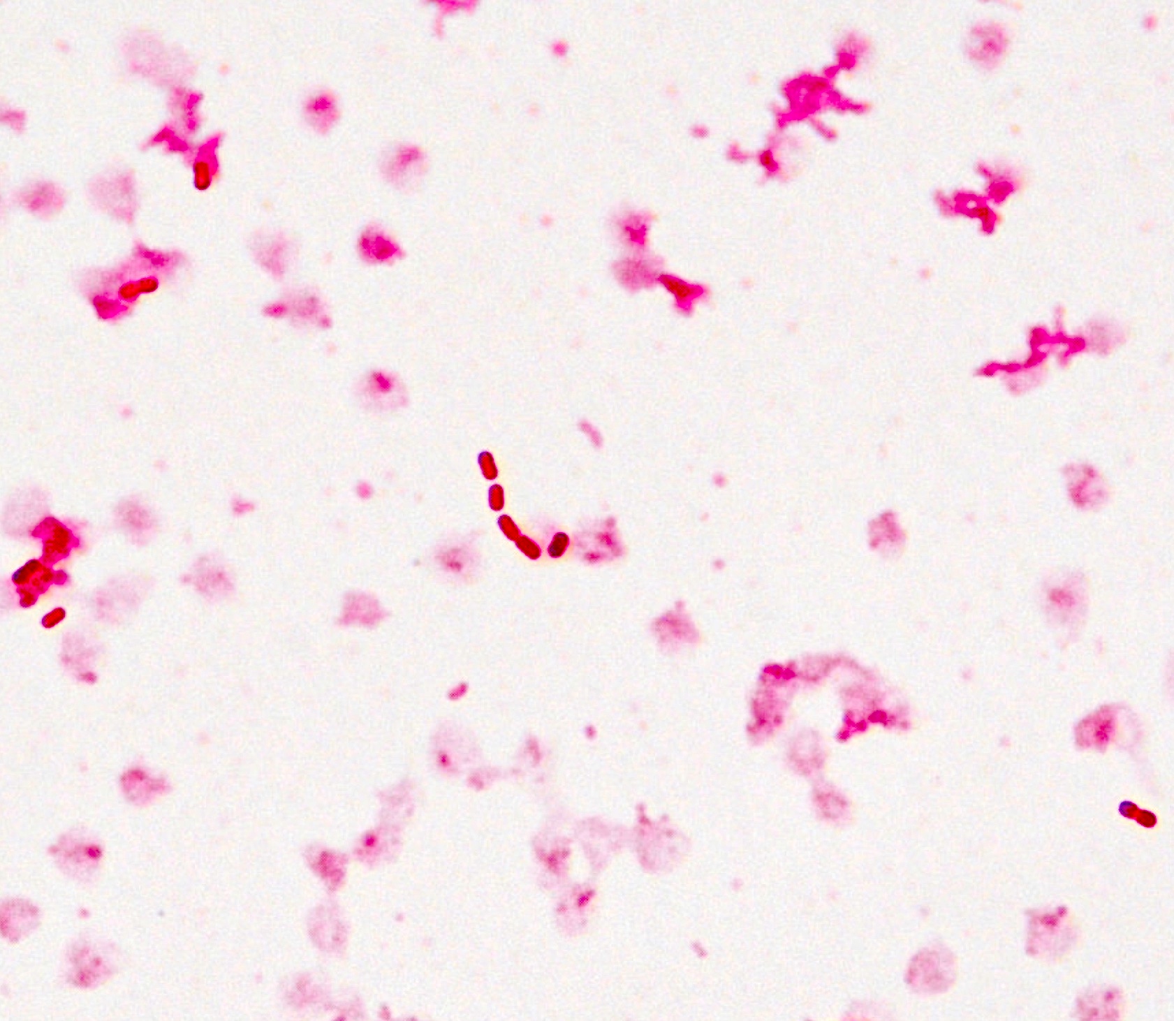 klebsiella pneumoniae capsule stain 100x