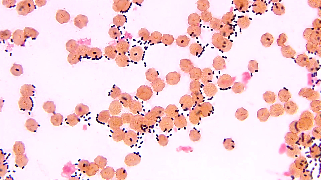 streptococcus pneumoniae colony morphology