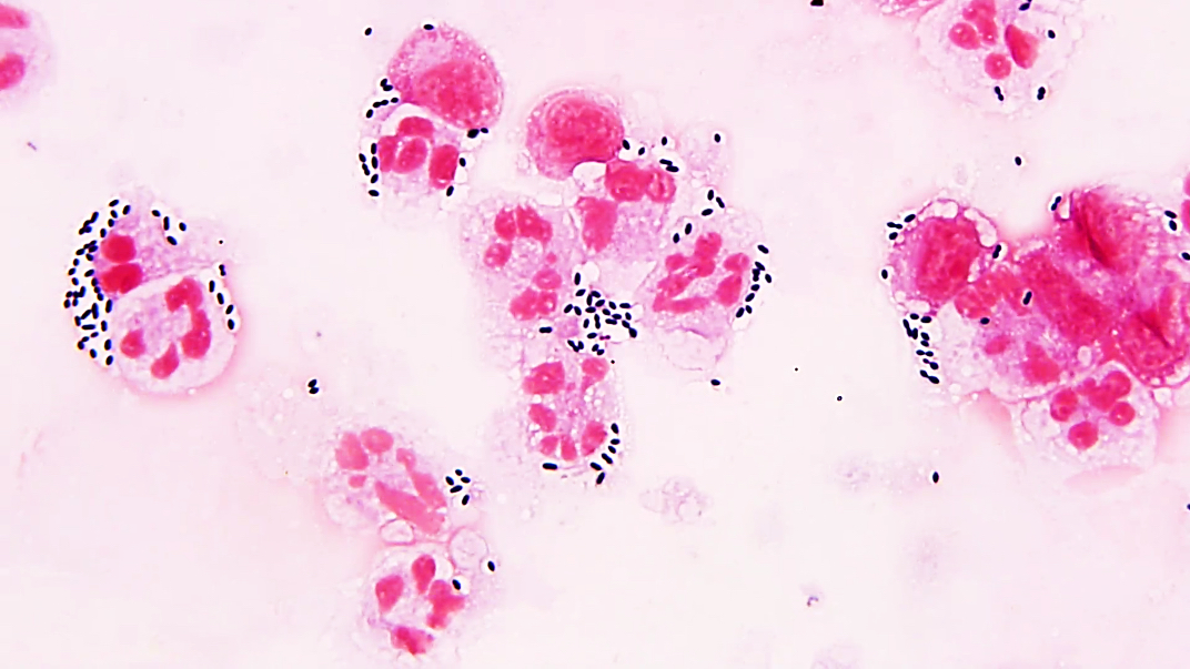 streptococcus gram stain