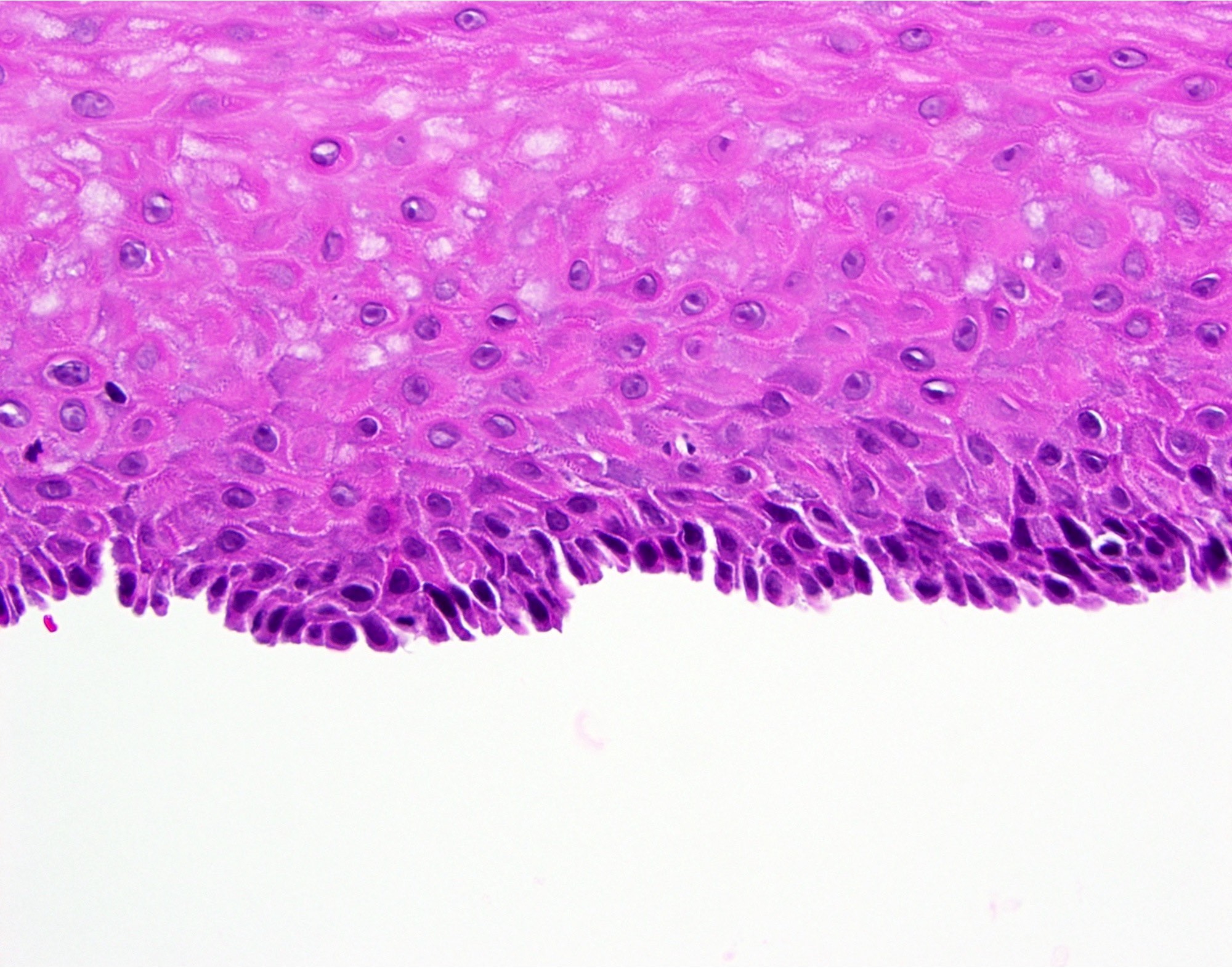 mucous membrane pemphigoid histology
