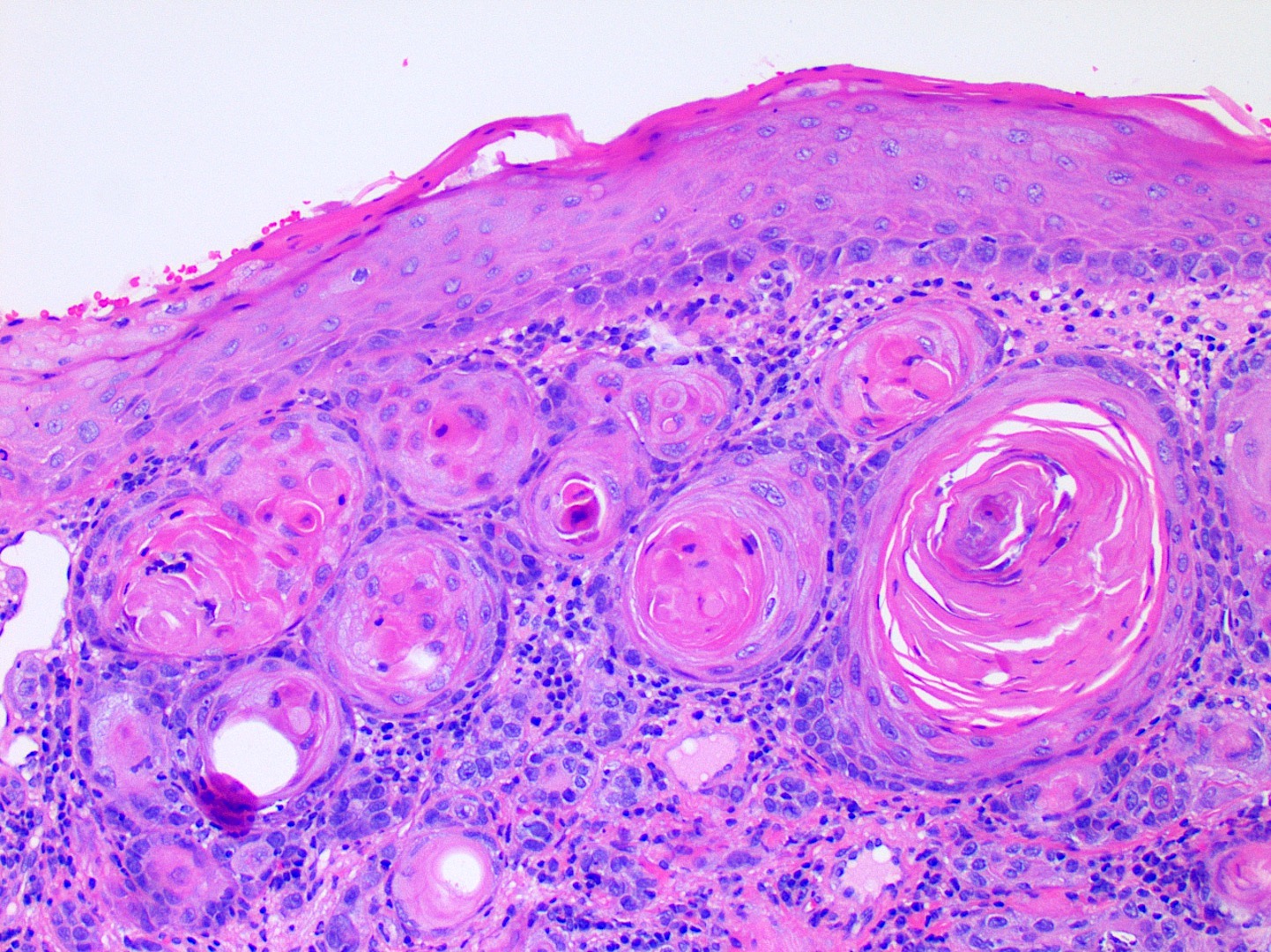 alveolar mucosa histology