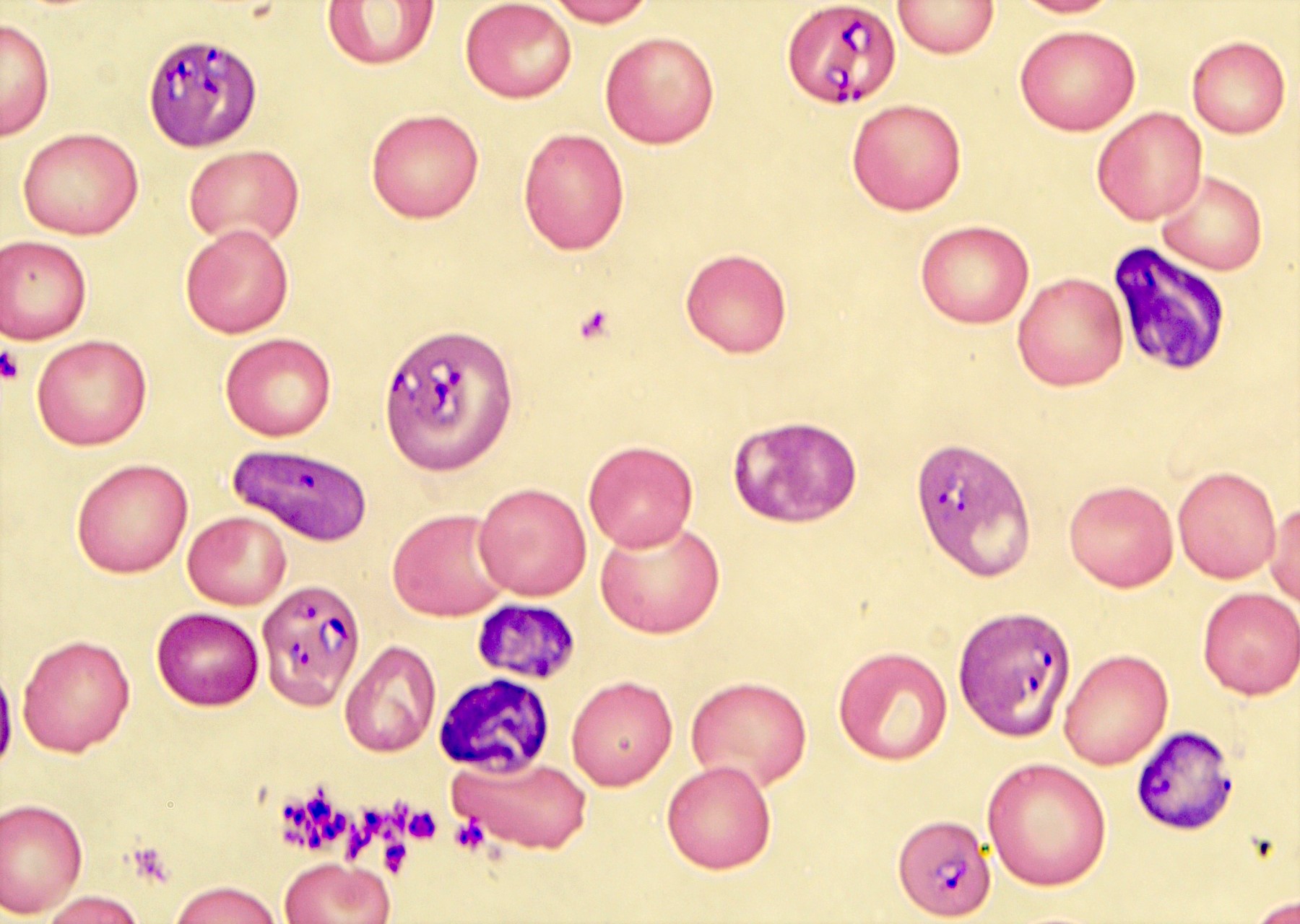 E) Brilliant Babesia piroplasm inside RBC in thick blood smear. (F)