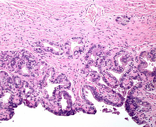 Tumors of the Prostate Gland，Seminal Vesicles，Penis，and Scrotum (AFIP Atlas of Tumor Pathology: Series 4) Epstein，Jonathan I.