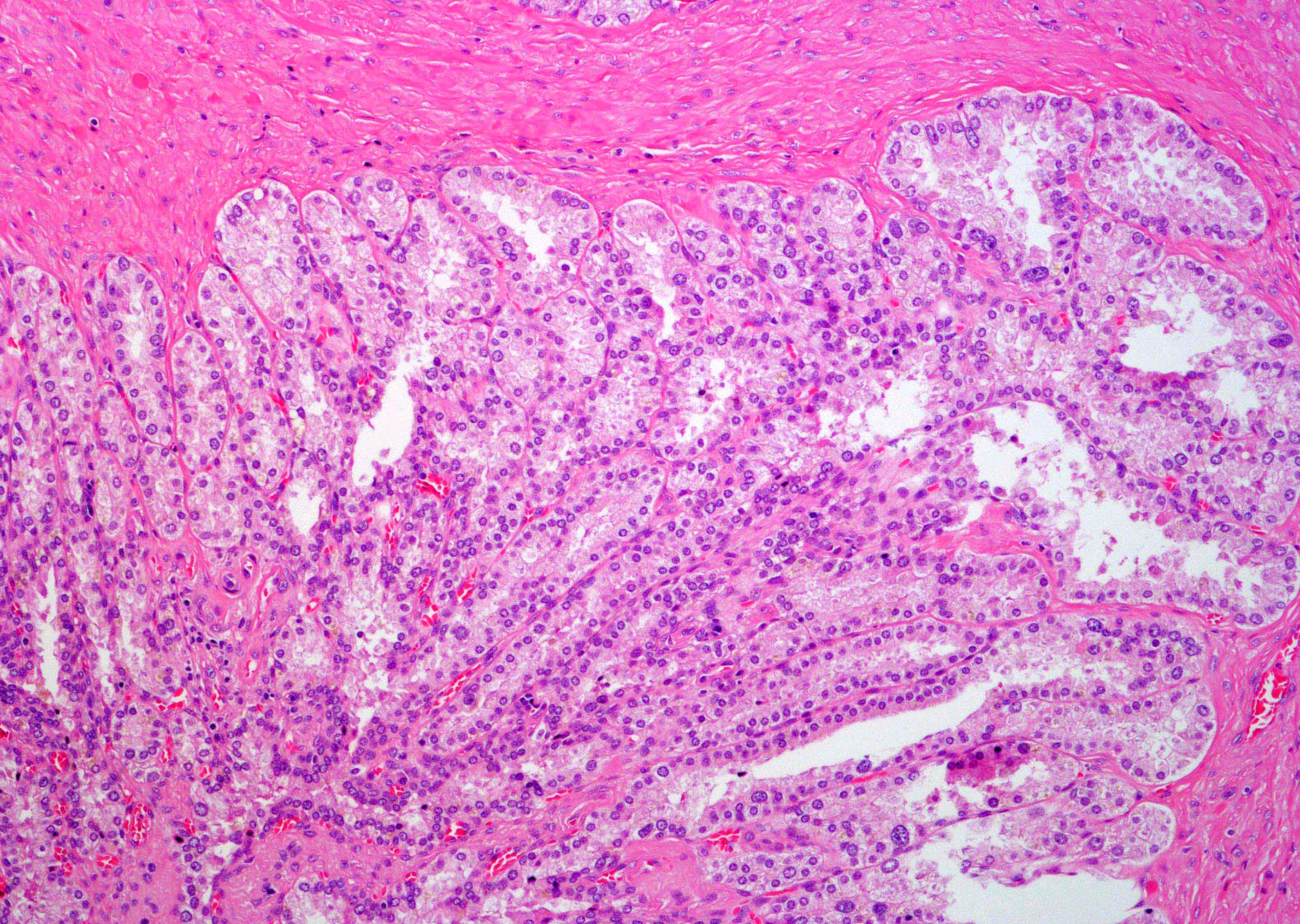 Pathology Outlines - Anatomy & histology-seminal vesicles