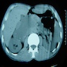 CT without contrast