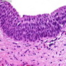 Pathology Outlines - Histology