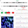 COL1A1::MIR29B2CHG fusion