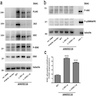 ERK phosphorylation