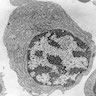 Pathology Outlines - Plasma cells