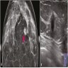 Digital mammography and ultrasound