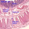 Pathology Outlines - Histology