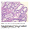 Pathology Outlines - Inflammatory myoglandular polyp of colon