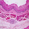 Pathology Outlines - Histology