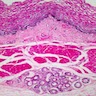 Pathology Outlines - Histology