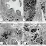 Inclusions in different cells