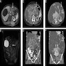 CT and MRI