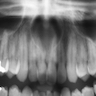 Panoramic radiograph