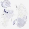 OCT3/4 immunostain