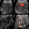 Sonographic features