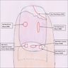 Nail apparatus biopsy sites