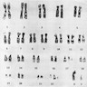 Karyotype