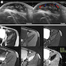 Ultrasonographic findings, MRI