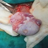 Multiple tunica vaginalis nodules