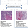 PDTC versus DHGTC