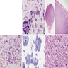 Microfollicular pattern