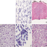 Dyshesive single cell pattern