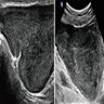 Ultrasound and MRI